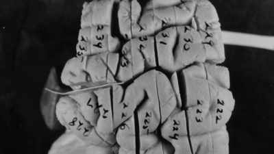 So, at first, I was stunned
that it was really there, - The Man Who Stole Einstein's Brain