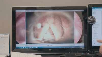 So we change your vocal cord
more shorter, thinner
and tighter. - Transformer
