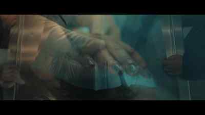 So, clearly, we have discoloration
throughout the hand. - Under the Bridge