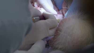 So dr. Berning has to go in
and retrieve that tooth root. - Secrets of the Zoo
