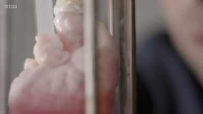So, for example, skin stem cells
can only produce skin cells. - The Human Body: Secrets of Your Life Revealed
