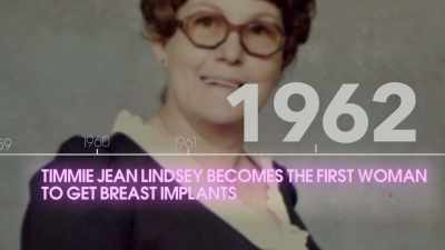 So my implants were put in long
about '62. - Explant