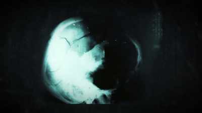So in any standard autopsy, - JFK: What The Doctors Saw