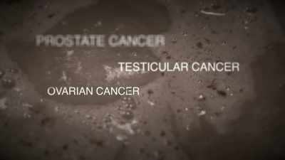 So that includes prostate,
testicular, ovarian, - Toxic Beauty