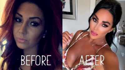 So I've had your fillers,
your lip fillers, my botox, - Naked Education