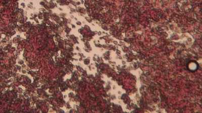 So that's an energy source
for healthy cells, - The Magic Pill