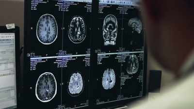So the brains of traumatized children - The Wisdom of Trauma