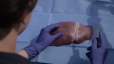 So, the left lobe, - The Good Doctor