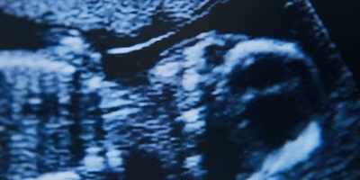 So, the placenta looks
nice and healthy. - Sulphur and White
