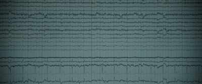 So we went and
applied an EEG to see - After Death