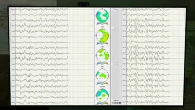 So when you read the EEG, - Beyond Skinwalker Ranch