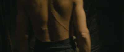 Some battle scars, but
many are from his spies. - The Great Battle