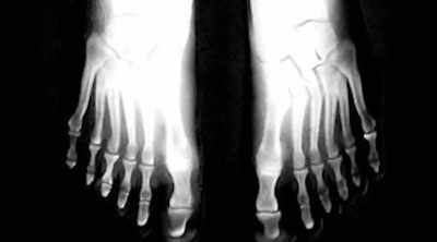 Some cases where the giants - Alien Worlds: Giants and Hybrids