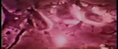 Some have suggested
that I affect the midbrain, - MK Ultra