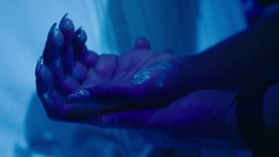 Some more around her fingers, - The Resident