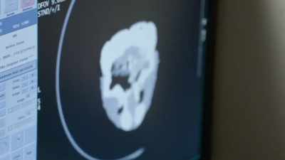 Something that we
couldn't have done
without that ct scan. - Secrets of the Zoo