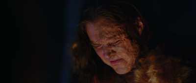 Sometimes I wake up feeling
like my skin's on fire. - Buckskin