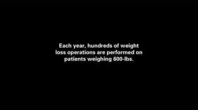 SOMETIMES, IT FEELS LIKE I'M
DEAD, LIKE THAT I'M NOT ALIVE. - My 600-lb Life