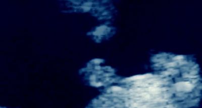 SONOGRAPHER Is that too cold KATE No it's fine - The Ones Below