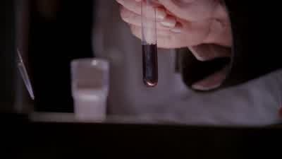 Start the patient on 150 milligrams glucose, 75 milligrams hematin. - House