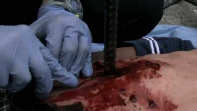 Suction. Come on, suction. - Trauma
