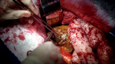 Suction. - Grey's Anatomy