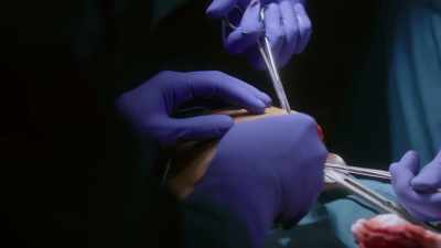 t-e-e-showing-anterior-wall-hypokinesis - The Good Doctor