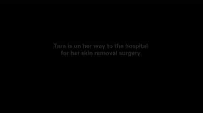 Tara: [ Voice breaking ]
IT'S A REALLY BIG SURGERY. - My 600-lb Life