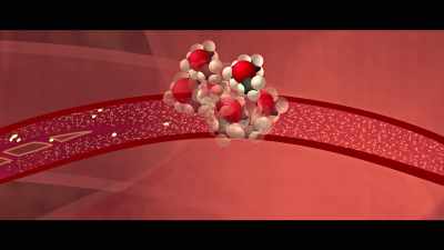 That molecule drives cholesterol 
into the artery walls - What the Health