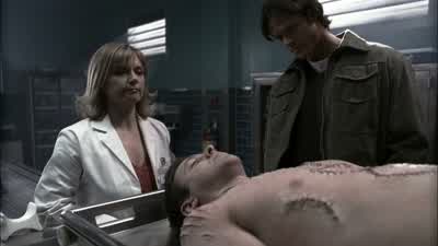 -That's a pretty nasty bite. - Supernatural