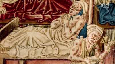 That's when septicaemia happens, - Curse of the Ancients with Alice Roberts