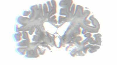 That's the big question. - The Mind, Explained
