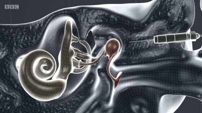The ambition is for this new
technology - Surgeons: At the Edge of Life
