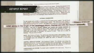 The autopsy showed - Buried In The Backyard