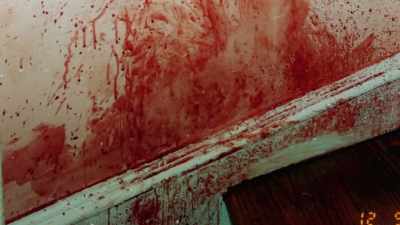 The blood makes the case. - An American Murder Mystery: The Staircase