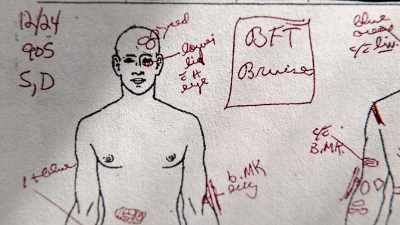 "The body is covered
with blunt force injuries - Killing County