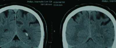 The brain is a prediction
machine that is designed - After Death