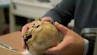 The brain boiled, there was an increase in
the intercranial pressure. - Lost Treasures of Rome
