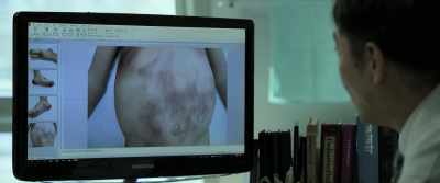 The direct cause
of death is peritonitis - My First Client
