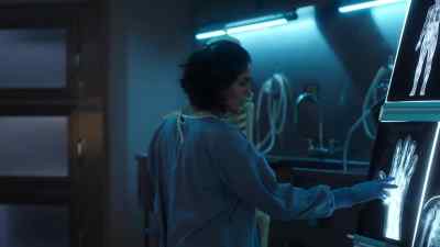 The fingers on his right
hand are broken. - CSI: Vegas