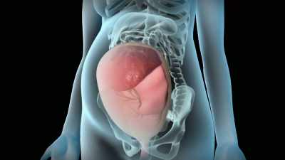 The first perinatal matrix
relates to the situation - The Way of the Psychonaut