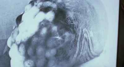 The first tests
all show the same results. - Contamination