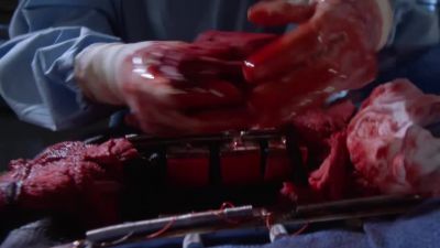 The heart, Helm, where's the heart? - Grey's Anatomy
