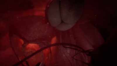The heart itself
is just two pumps - Human: The World Within