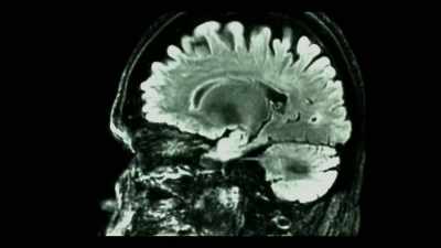 The higher the
frequency of the brain, - Teslafy Me