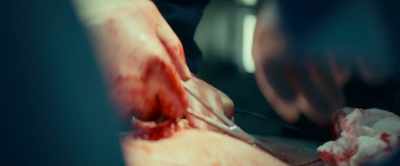 The internal organ
will be repaired, - Halloween Kills