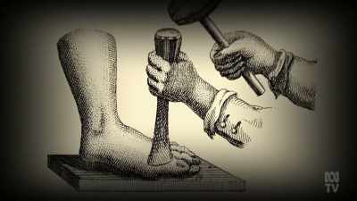 The main culprit? Infection. - Aussie Inventions That Changed The World