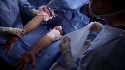 The minute we remove the
arms from the donor, - Grey's Anatomy