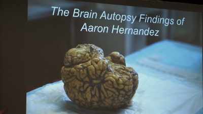 The most significant...
That this for an individual - Killer Inside: The Mind of Aaron Hernandez