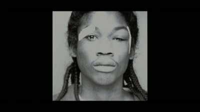 The multiple injuries
Meek suffered - Free Meek
